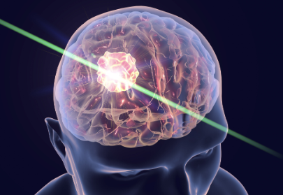 術(shù)中成像用藍(lán)寶石 術(shù)中成像用藍(lán)寶石